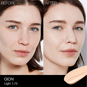 BEFORE & AFTER