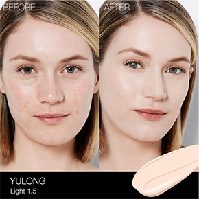 BEFORE & AFTER